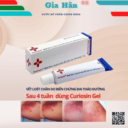 Curiosin Gel hỗ trợ làm lành vết thương xước, trầy, vết cắt, vết bỏng nhẹ - Hungary.