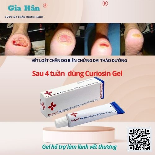 Curiosin Gel hỗ trợ làm lành vết thương xước, trầy, vết cắt, vết bỏng nhẹ - Hungary.