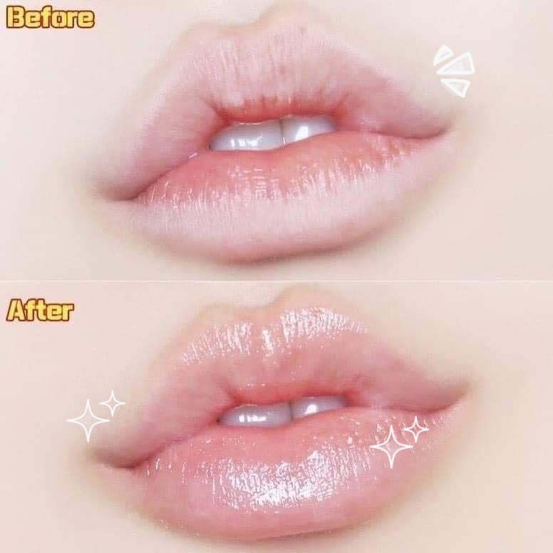 Son Dưỡng Mediheal Labocare Panteno Lips