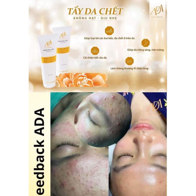 tẩy da chết ADA GROUP