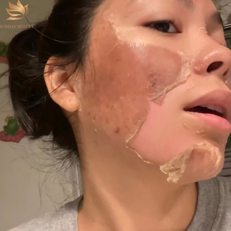 Peel da ROYCE SKIN M+ Nám tàn nhang mụn thâm sẹo rỗ lõm da bong mảng to m0