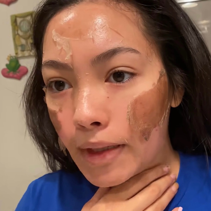 Peel da ROYCE SKIN M+ Nám tàn nhang mụn thâm sẹo rỗ lõm da bong mảng to m0