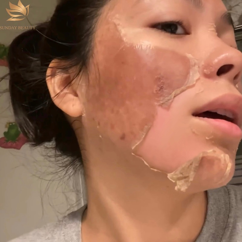 Peel da ROYCE SKIN M+ da bong mảng to bóc tách mụn thâm sẹo rỗ lom nám tàn nhang m0