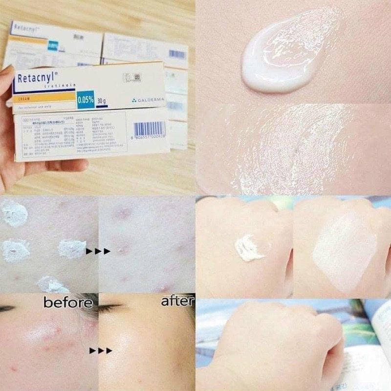 Kem Retacnyl Cream Giảm Mụn Chống Lão Hoá 30g