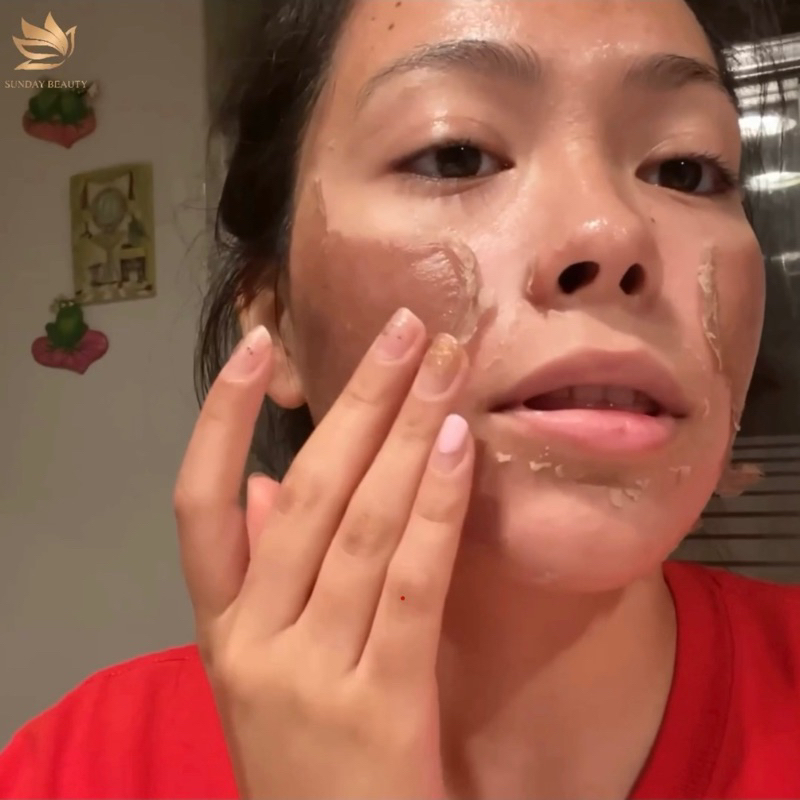 Peel da ROYCE SKIN M+ da bong mảng to bóc tách sẹo rỗ lõm mụn thâm nám tàn nhang m0
