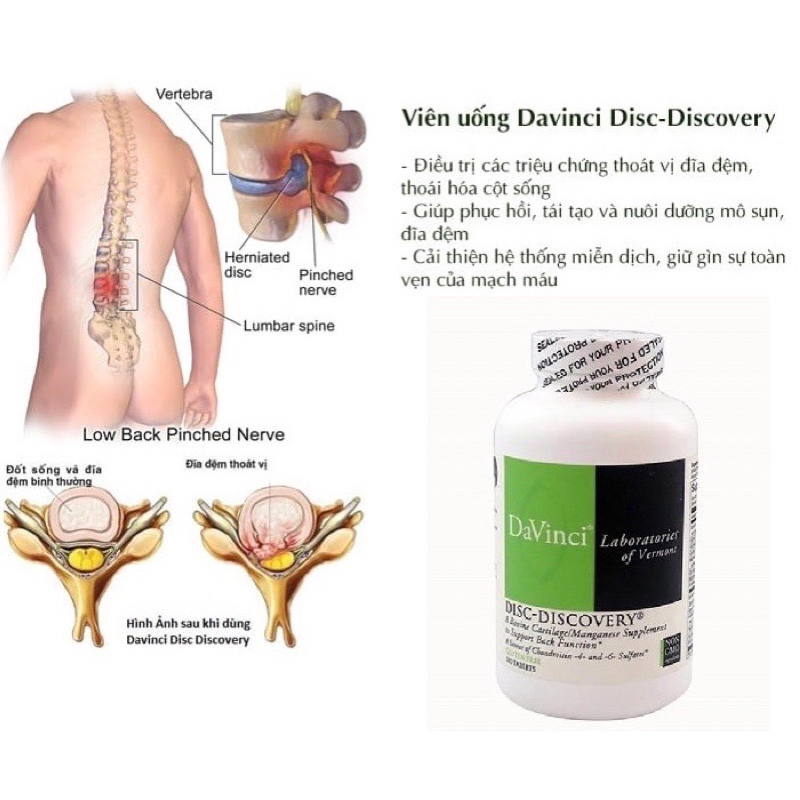 Viên Uống Davinci Disc Discovery Hỗ Trợ Thoái Hóa Cột Sống Và Thoát Vị Đĩa Đệm
