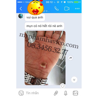 MỤN CÓC RAPHA