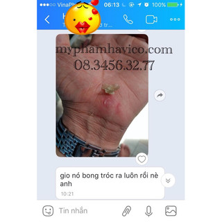 MỤN CÓC RAPHA