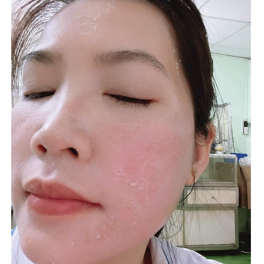 Kem tái tạo nội sinh Mq skin chính hãng