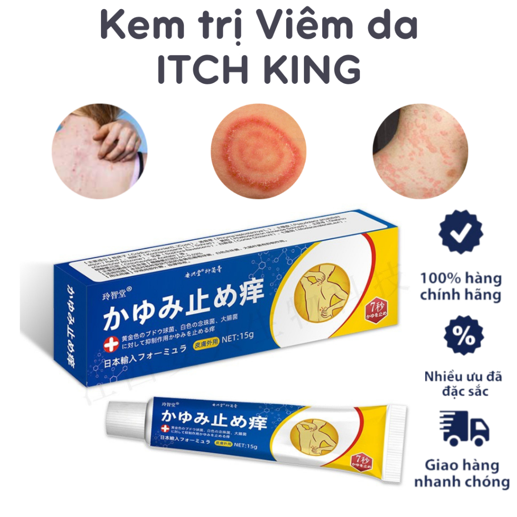 Kem ITCH KING bôi viêm da cơ địa nhập khẩu chính hãng