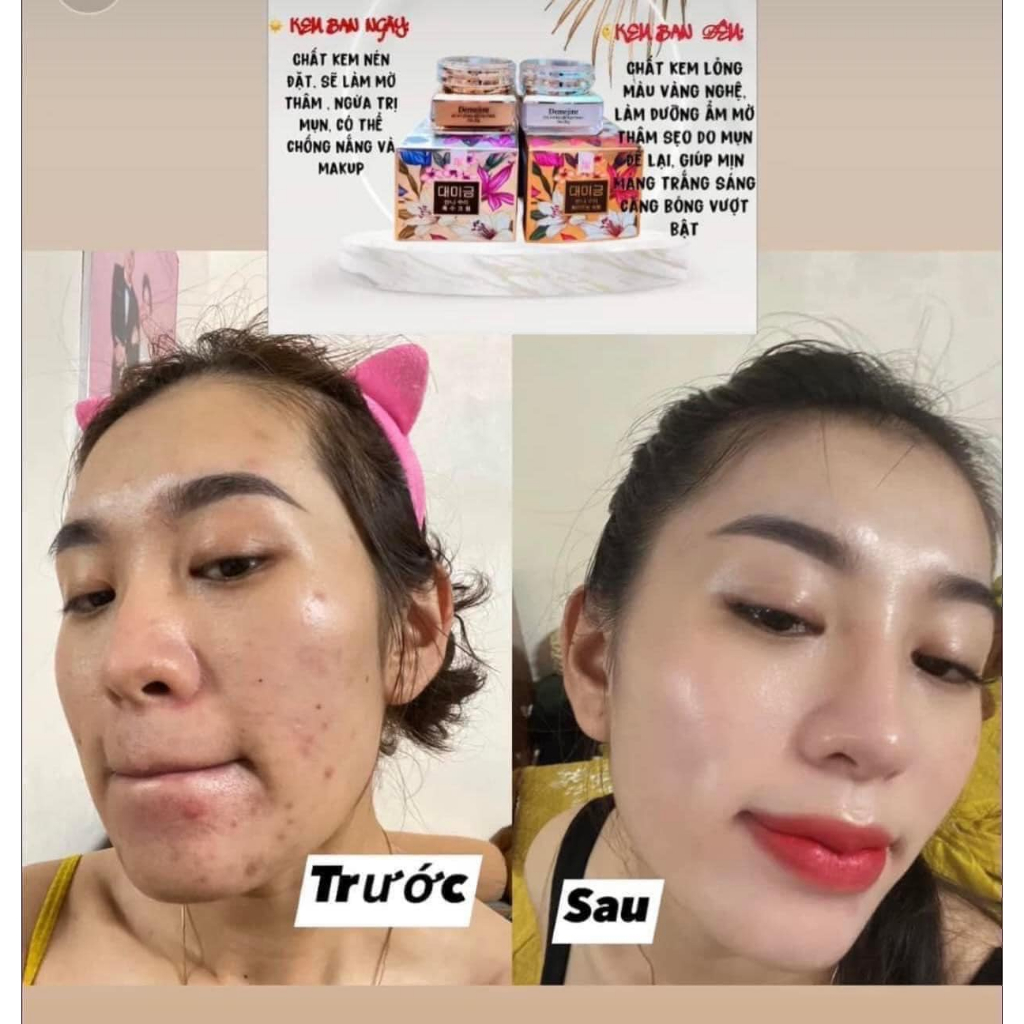 Kem Face Demejine Dưỡng Trắng Da Tái Tạo Da Mặt Mờ Nám Tàn Nhan Ngày Và Đêm Hộp 20gr
