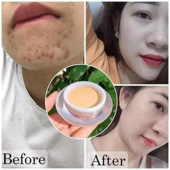 Kem Face Pháp A cosmetics dưỡng trắng da mặt 20g, dưỡng da sáng mịn đều màu da