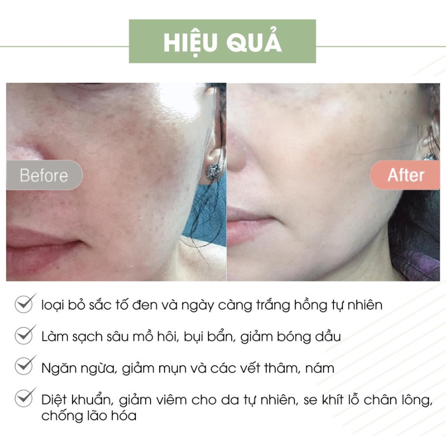 Kem Face Pháp A cosmetics dưỡng trắng da mặt 20g, dưỡng da sáng mịn đều màu da