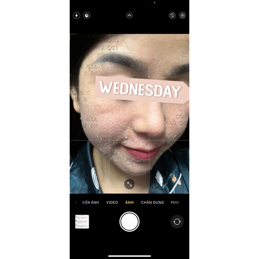 Nạ Tươi Ủ Kích Bong Da