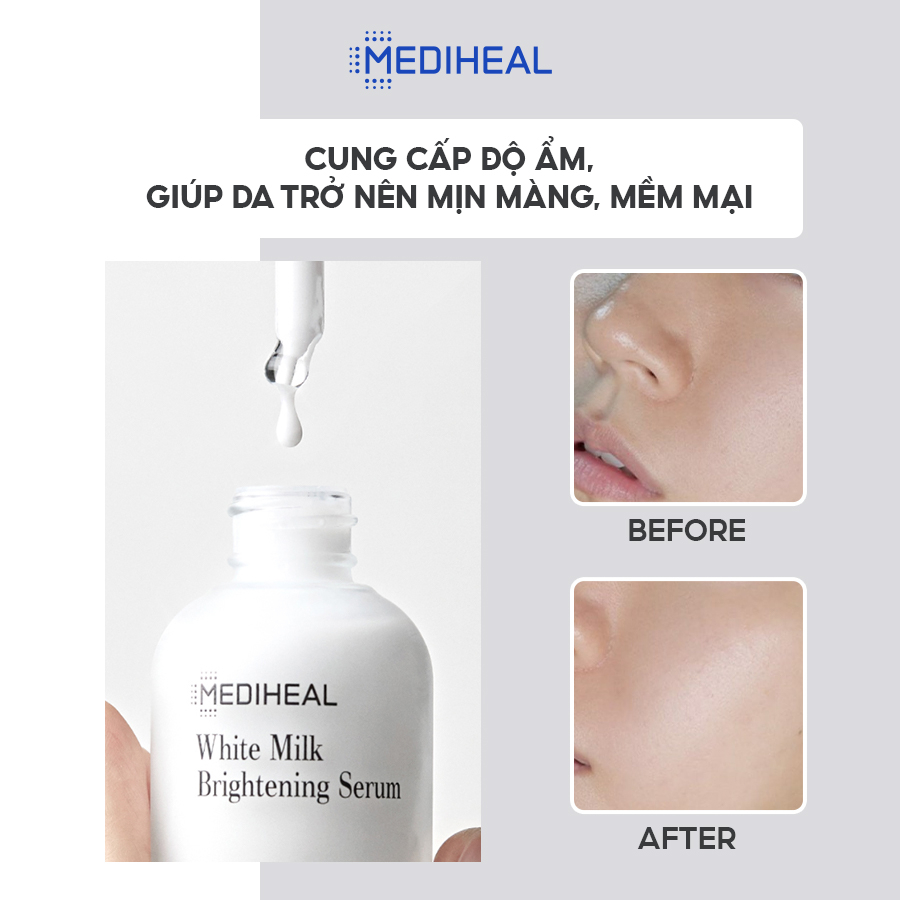 Tinh Chất Dưỡng Da Dạng Sữa, Làm Da Tươi Tắn MEDIHEAL Milk Brightening Serum 40ml