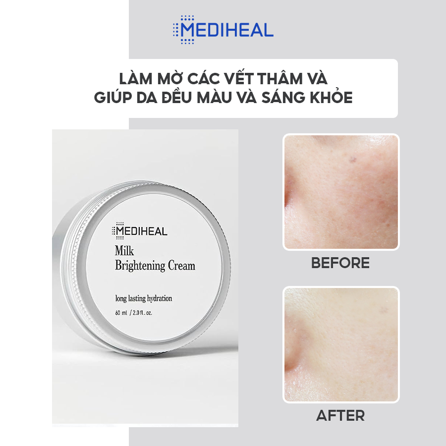 Kem Dưỡng Ẩm, Làm Sáng Da MEDIHEAL Milk Brightening Cream 60ml