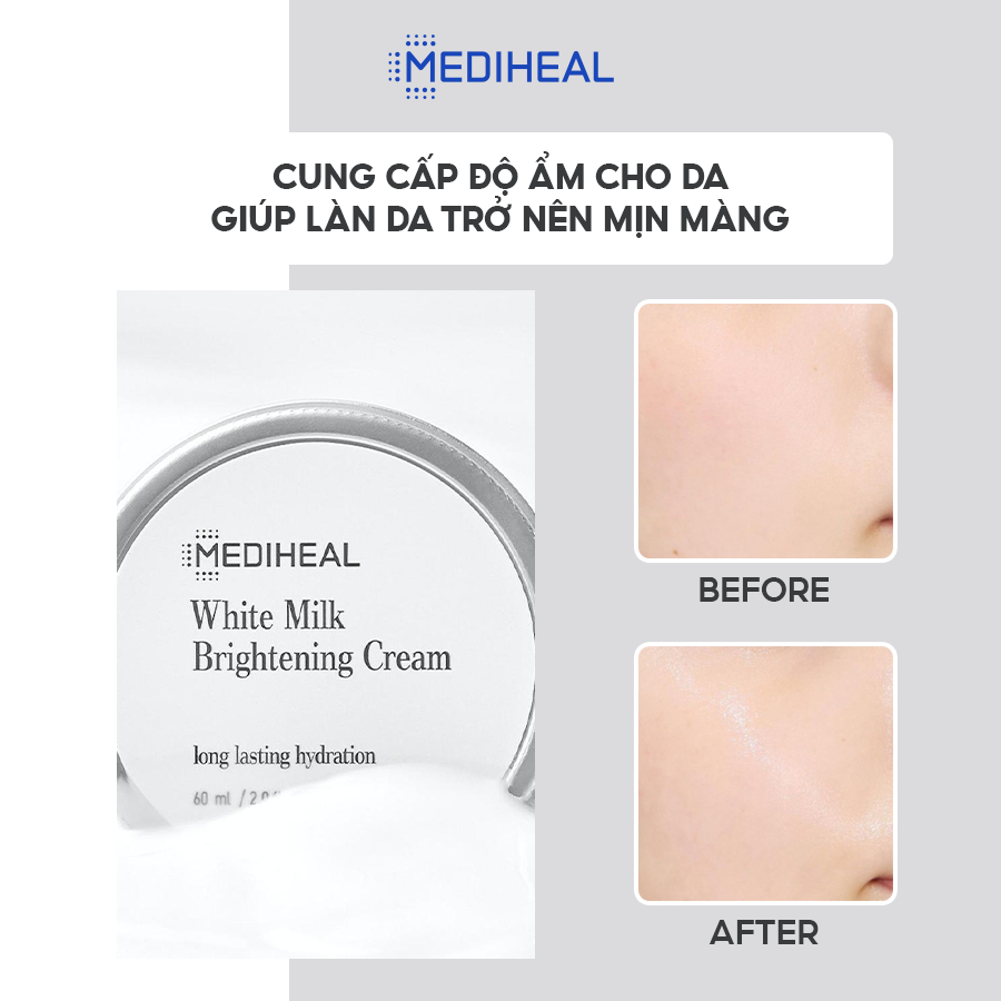 Kem Dưỡng Ẩm, Làm Sáng Da MEDIHEAL Milk Brightening Cream 60ml