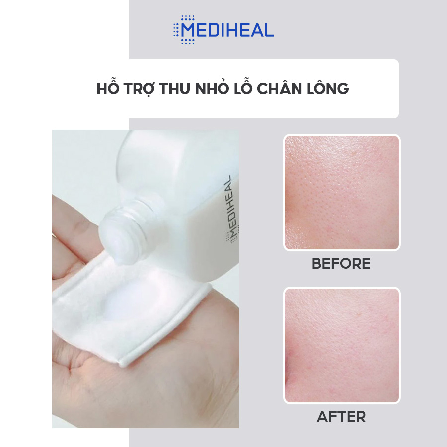 Nước Hoa Hồng Dưỡng Ẩm, Làm Sáng Da MEDIHEAL MILK BRIGHTENING TONER