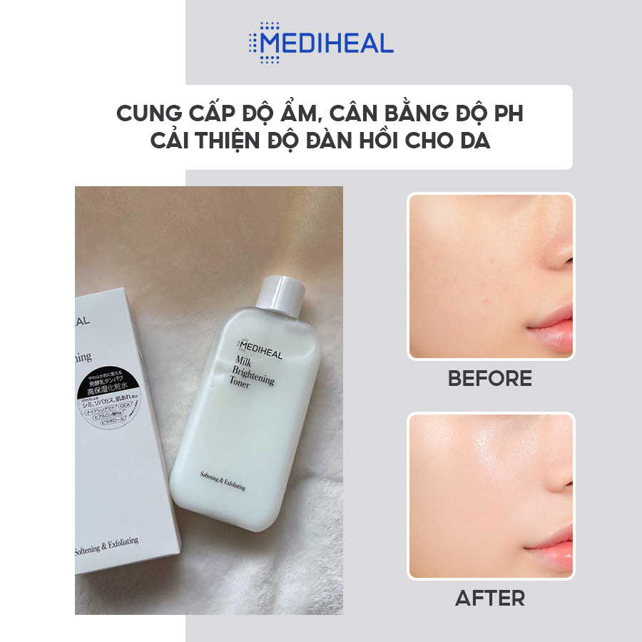 Nước Hoa Hồng Dưỡng Ẩm, Làm Sáng Da MEDIHEAL MILK BRIGHTENING TONER