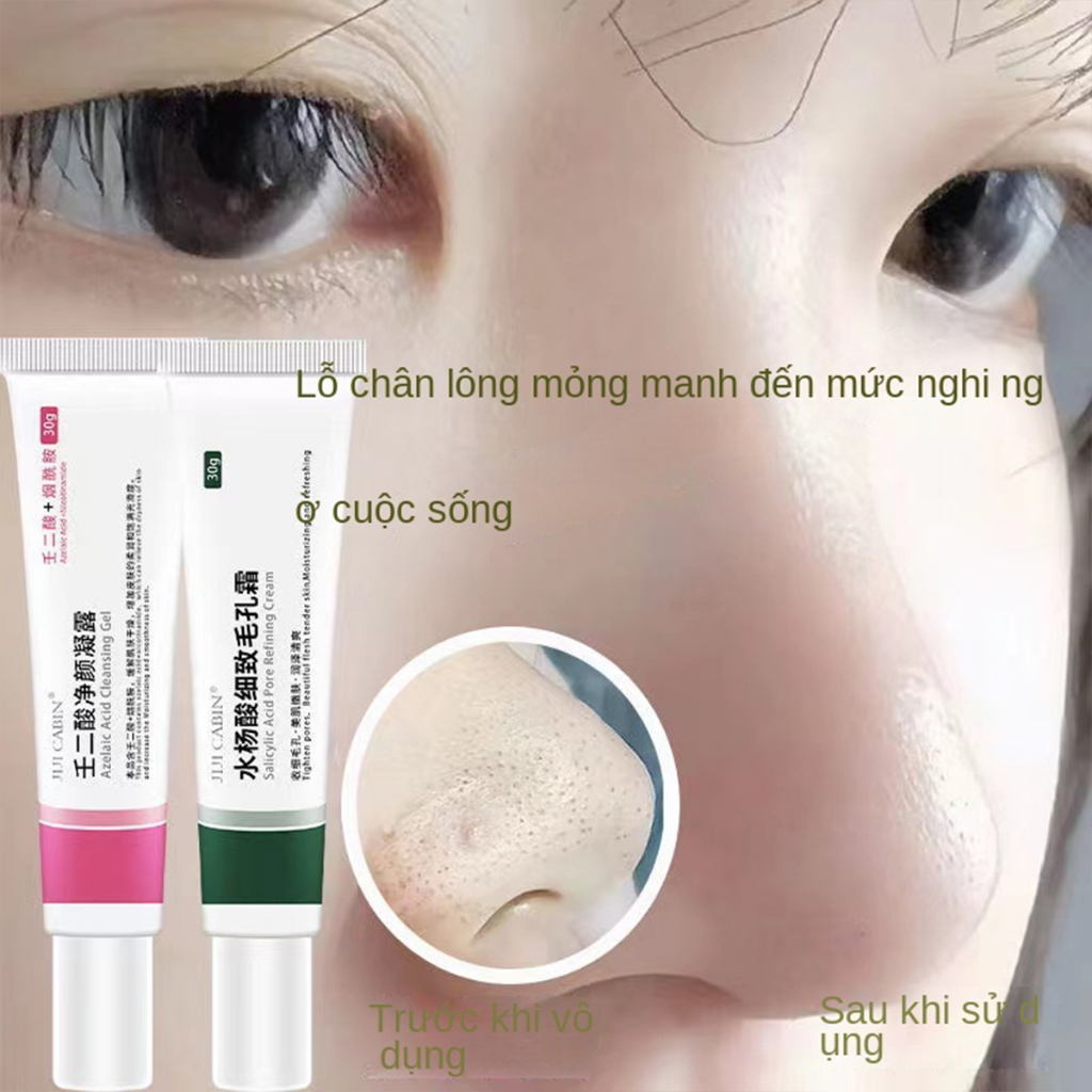 （MUA 1 TẶNG 1）Acne Kem Giảm Thâm Nám Và Ngăn Ngừa Mụn chứa 15% Azelaic 30ml