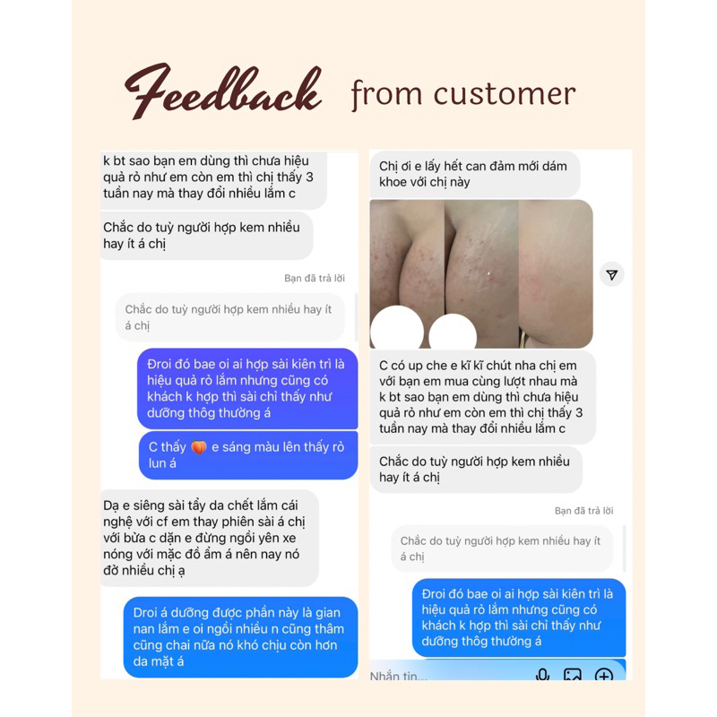 Kem dưỡng Butty Cream giảm thâm vùng nách, mông mỹ phẩm handmade