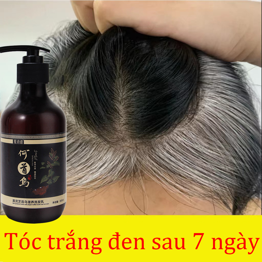 Dầu gội mọc tóc dầu gội thảo dược Giảm Rụng Tóc Bạc Tóc kích thích mọc tóc Chiết xuất thực vật loại bỏ gàu kiểm 300ML