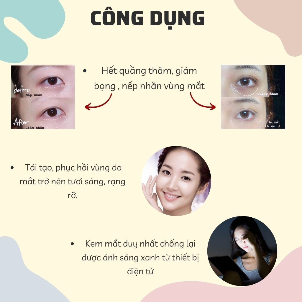 Kem giảm thâm mắt Kpem giảm thâm bọng mắt chống nhăn chống lão hóa dưỡng mắt 30ml