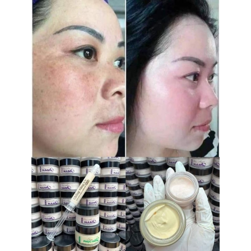 Combo Huyết sâm Hủy nám