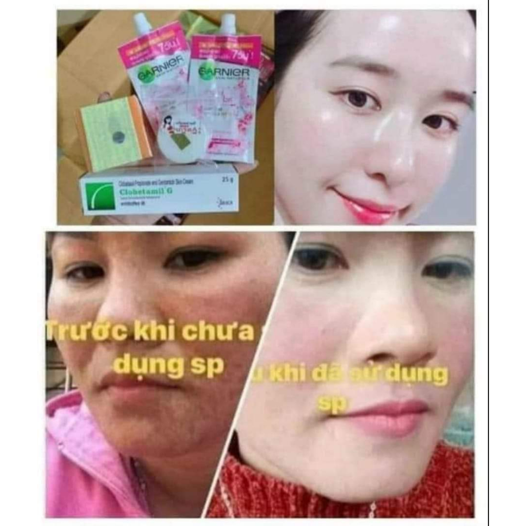 Sỉ 10 bộ kem nám thái lan dạng túi ríp