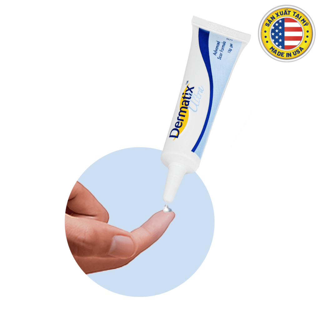 Dermatix Ultra Gel làm mờ sẹo thâm, sẹo lồi - Made in USA - Chính hãng