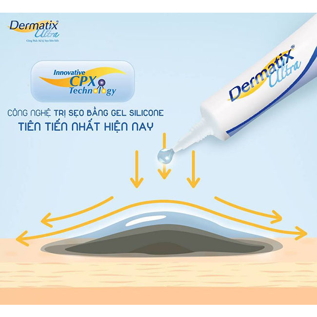 Dermatix Ultra Gel làm mờ sẹo thâm, sẹo lồi - Made in USA - Chính hãng