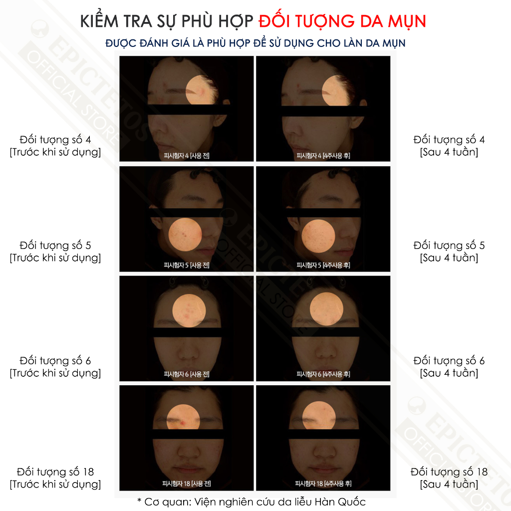 Kem Dưỡng Ẩm Và Phục Hồi 4 Trong 1 Epictetos Hur. Water Repair Cream 80g