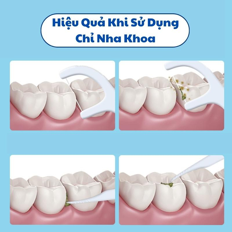 Tăm Chỉ Nha Khoa Nhật Bản Gói 50 Cây Loại Sạch Mảng Bám Thức Ăn Nằm Sâu Trong Kẽ Răng Ngăn Ngừa Hôi Miệng Sâu Răng