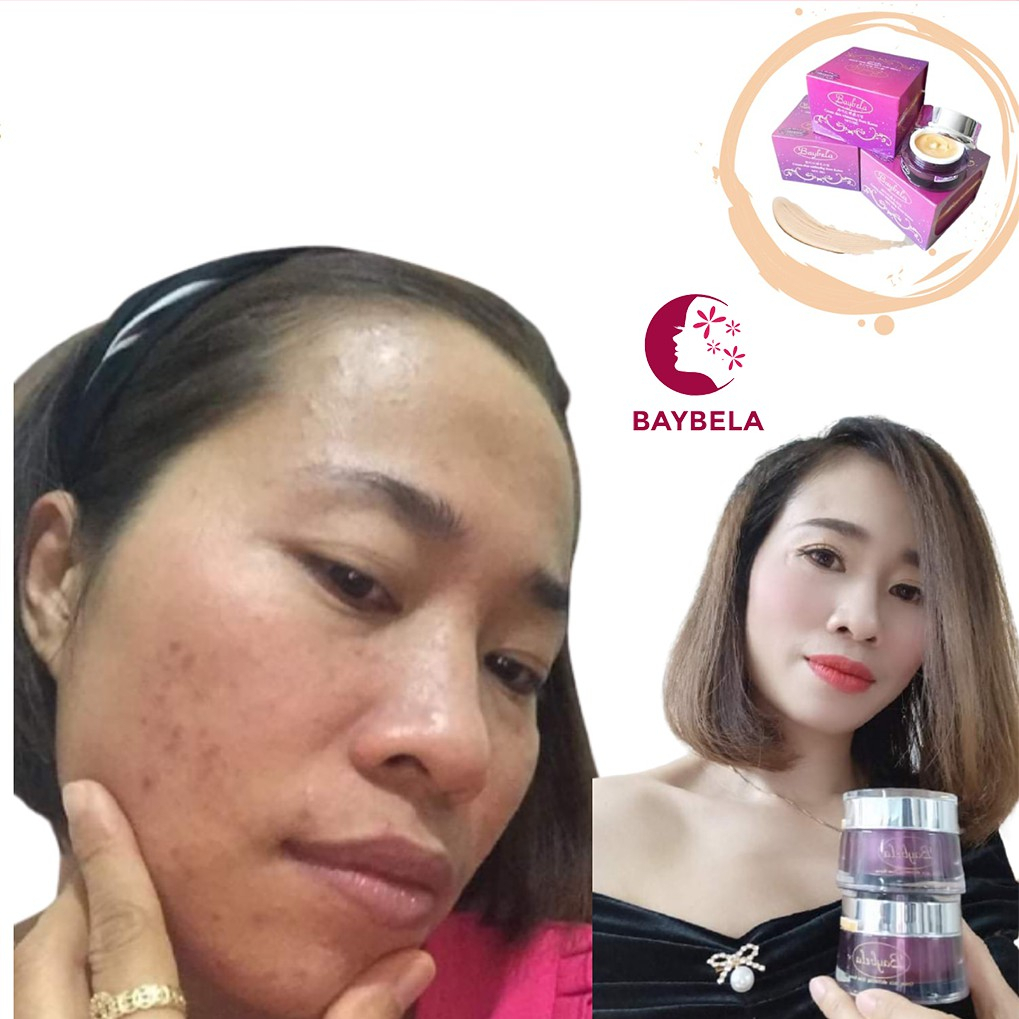 KEM TRẮNG DA CAO CẤP BAYBELA