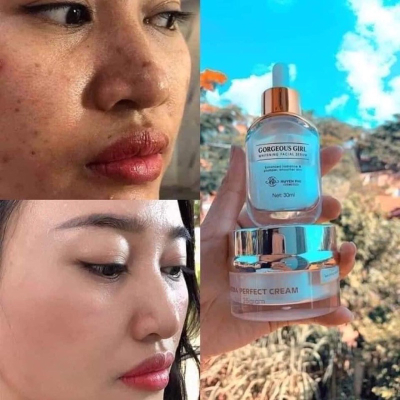 Bộ đôi kem abutin dưỡng trắng + serum sâm sạch nám ban đêm.