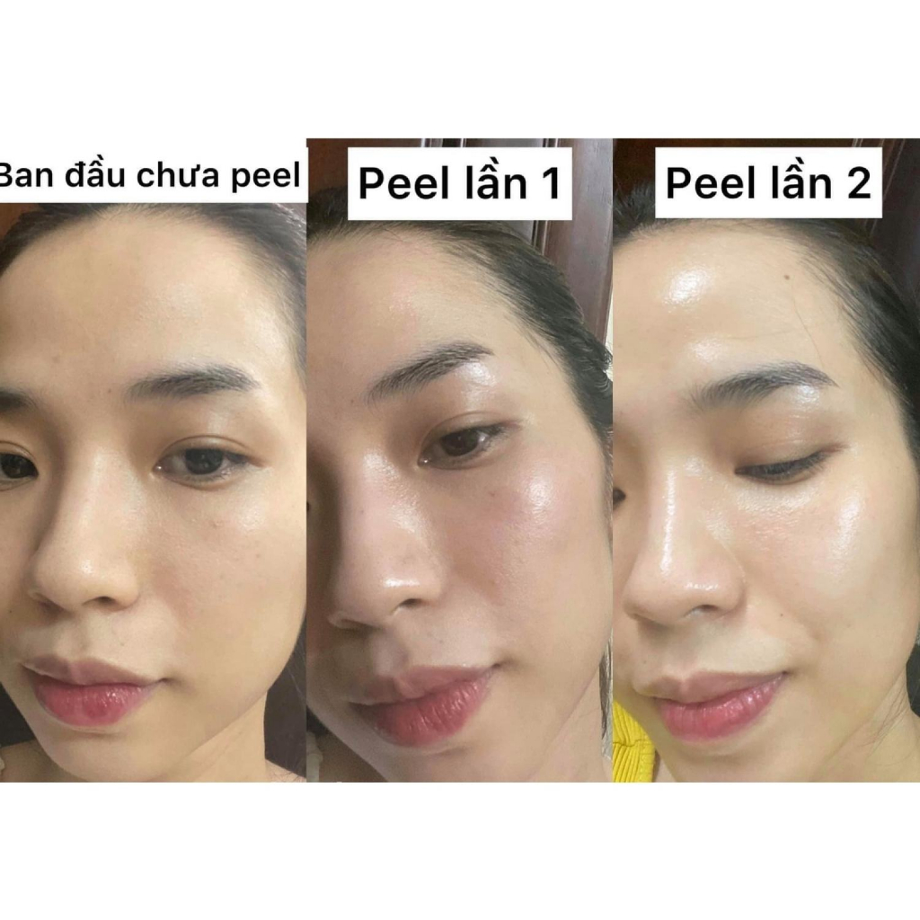 Măng tây baby -  Tinh chất peel da biorepeel cl3
