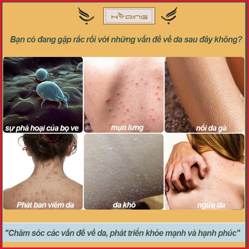 Sữa tắm trắng da Sữa tắm loại bỏ mụn Sữa tắm mụn lưng 500ml Làm sạch sâu bụi bẩn dưới da Cải thiện mụn trứn