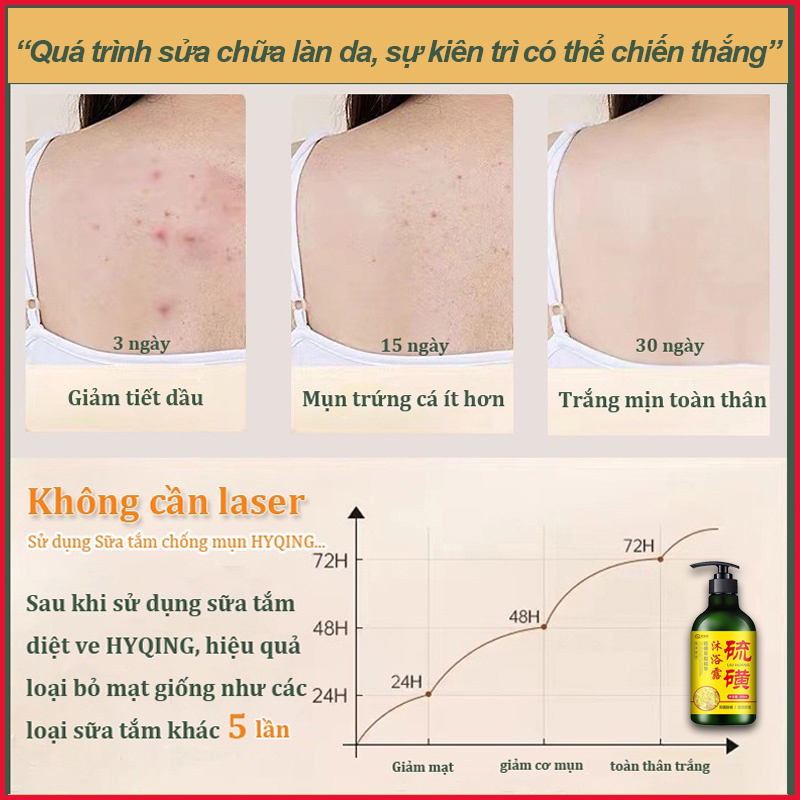 Sữa tắm trắng da Sữa tắm loại bỏ mụn Sữa tắm mụn lưng 500ml Làm sạch sâu bụi bẩn dưới da Cải thiện mụn trứn