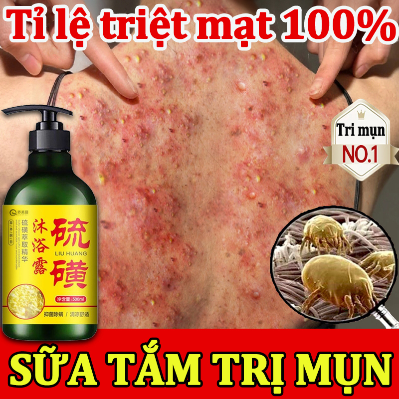Sữa tắm trắng da Sữa tắm loại bỏ mụn Sữa tắm mụn lưng 500ml Làm sạch sâu bụi bẩn dưới da Cải thiện mụn trứn