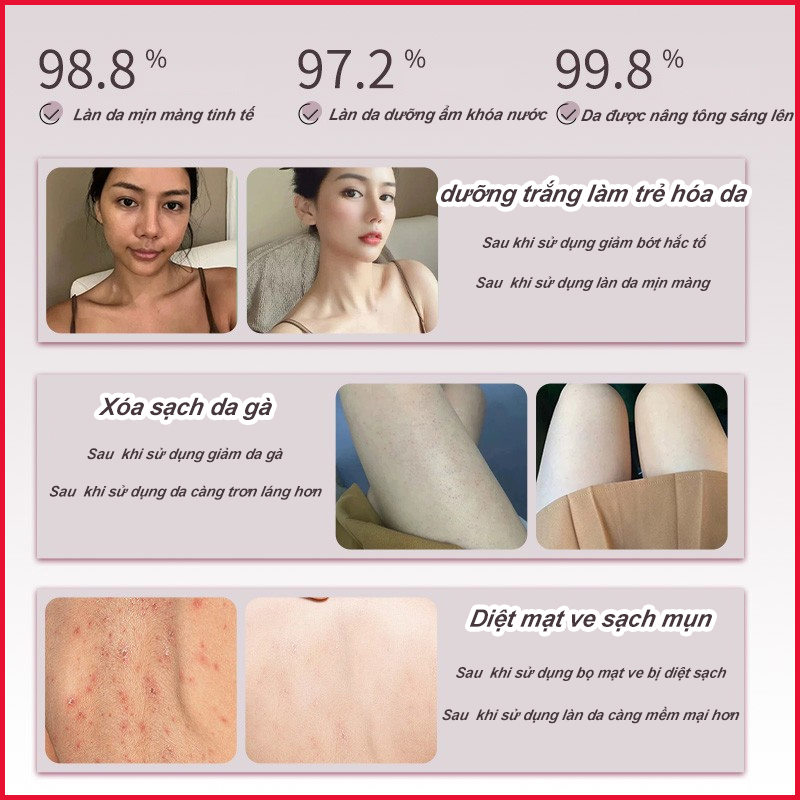 Sữa tắm trắng da Sữa tắm loại bỏ mụn Sữa tắm mụn lưng 500ml Làm sạch sâu bụi bẩn dưới da Cải thiện mụn trứn