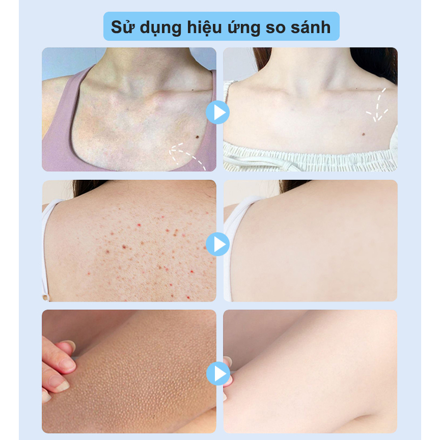 Sữa dưỡng thể Dưỡng trắng da body Niacinamide 300ML Cấp Ẩm Lâu Trôi Làm sáng tông màu da và có sẵn trên toàn cơ thể