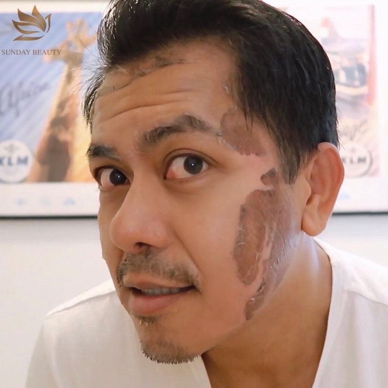 Peel da ROYCE SKIN M+ Da bong mảng to peel da làm đẹp theo xu hướng