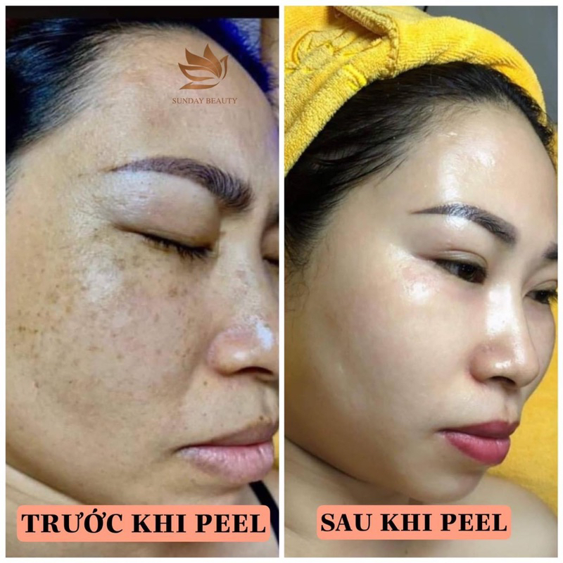 Peel da ROYCE SKIN M+ Peel da mang lại vẻ đẹp tiềm ẩn