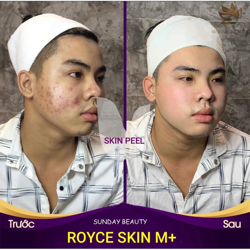 Peel da ROYCE SKIN M+ Peel da tiện lợi dễ sử dụng