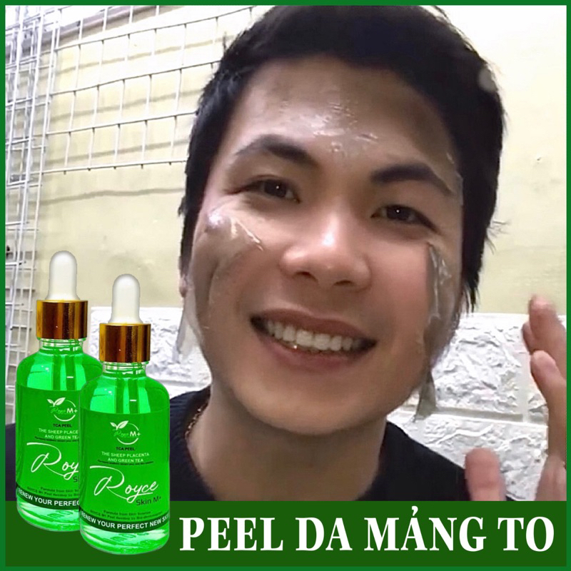 Peel da ROYCE SKIN M+ Peel da sành điệu nhất