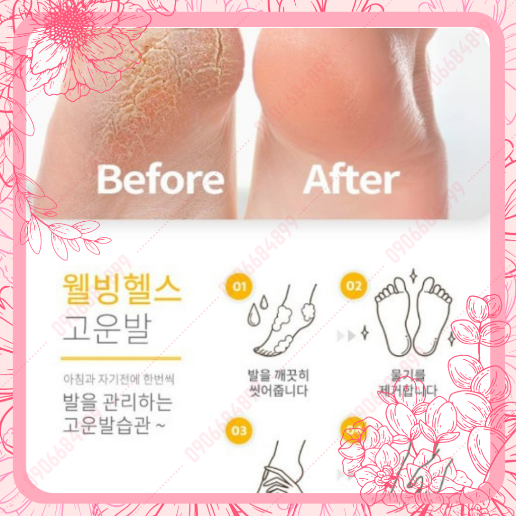 Kem dưỡng gót chân ⭐ PREMIUM FOOT CARE CREAM ⭐110gr