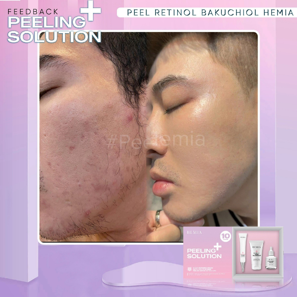 Bộ 3 sản phẩm peel da HEMIA gồm sữa rửa mặt cho da peel, tinh chất tái tạo retinol 0.5%, kem dưỡng phục hồi da