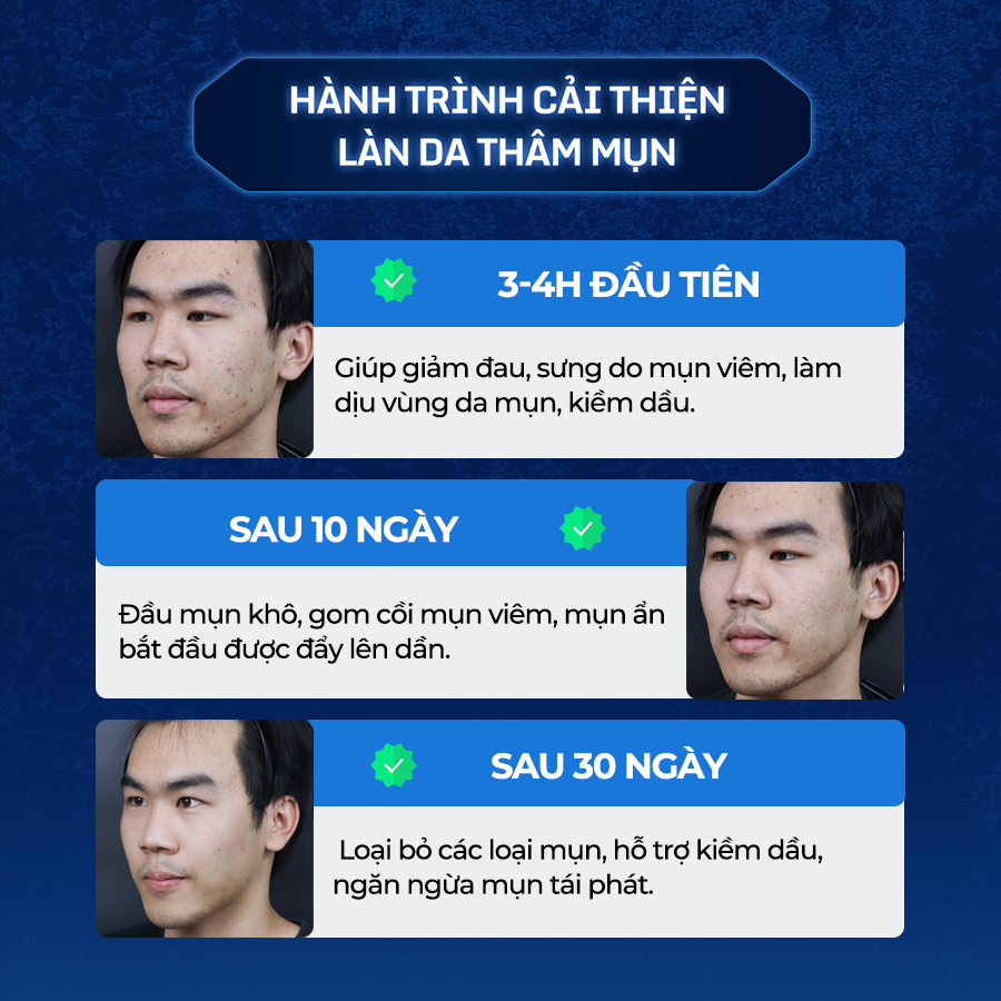 Tinh Chất Chấm Mụn Giúp Làm Khô Nhân Mụn,Làm Xẹp Mụn Viêm, Trứng Cá Và Mụn Đầu Đen The Menco Zinc White Acne 10ml