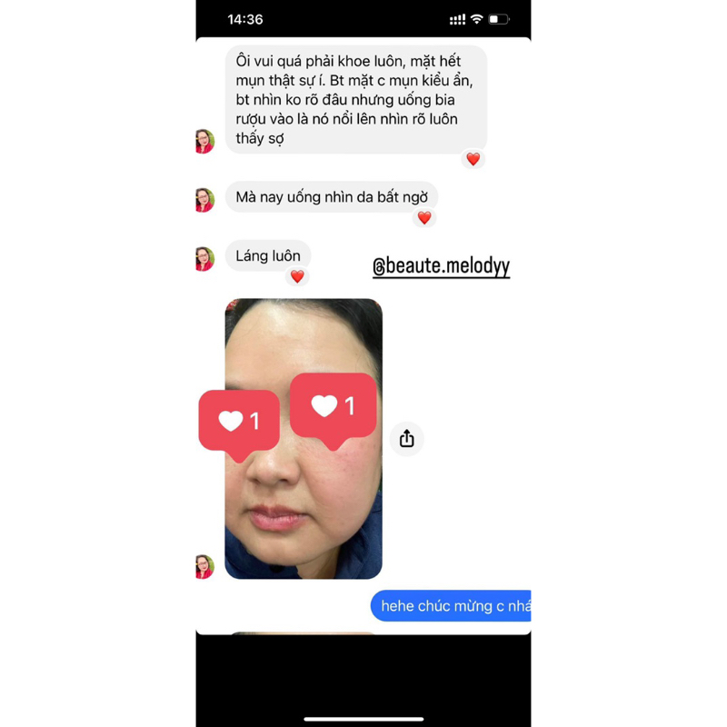 NƯỚC TẨY TRANG DÀNH CHO DA KHÔ VÀ DA MẤT NƯỚC DER…ME…DIC HY…DRA….IN3 500 ML