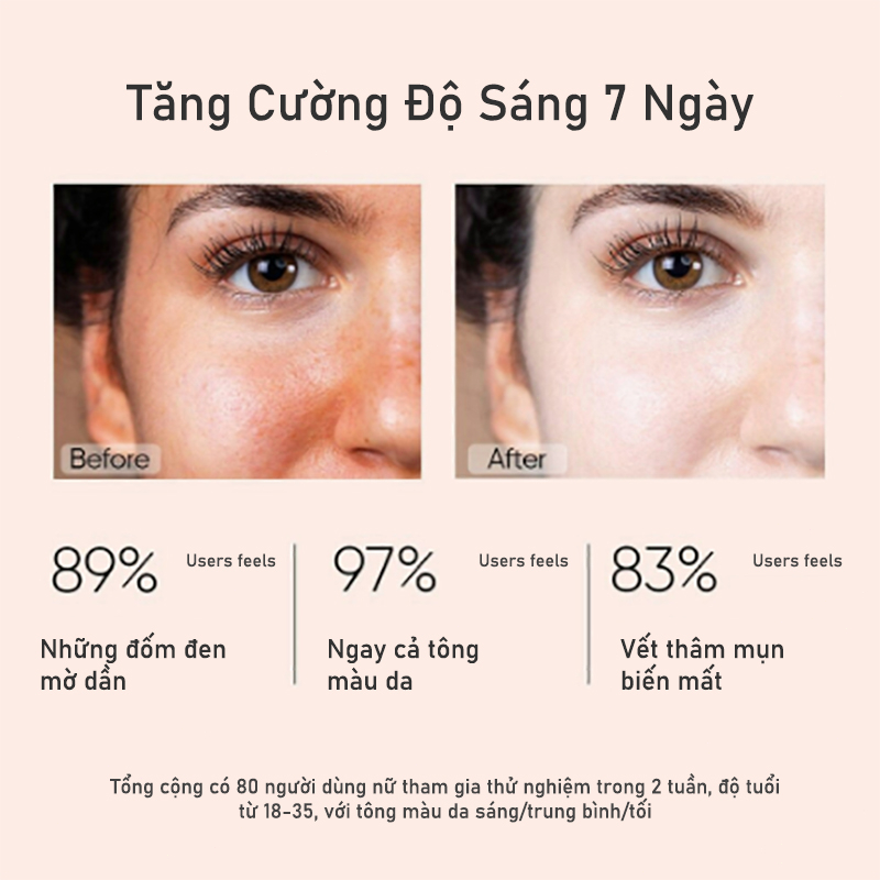 Tinh chất dưỡng serum trắng da tàn nhang kem nám tàn nhang 100ML giảm thâm se khít lỗ chân lông và trắng sáng da